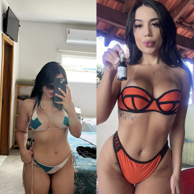 Antes e depois 2